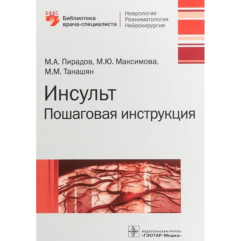 Инсульт. Пошаговая инструкция. Руководство