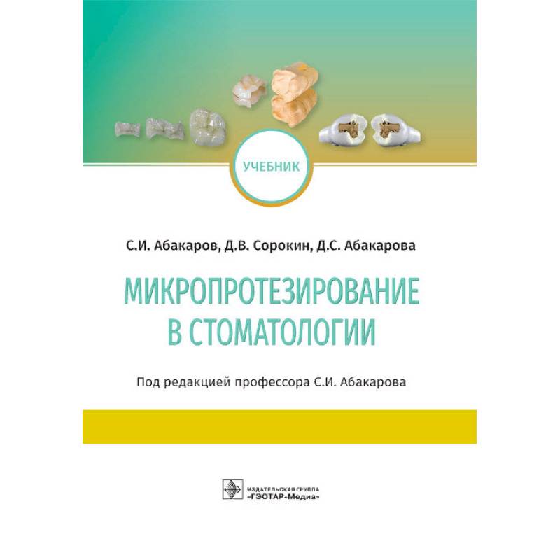 Микропротезирование в стоматологии