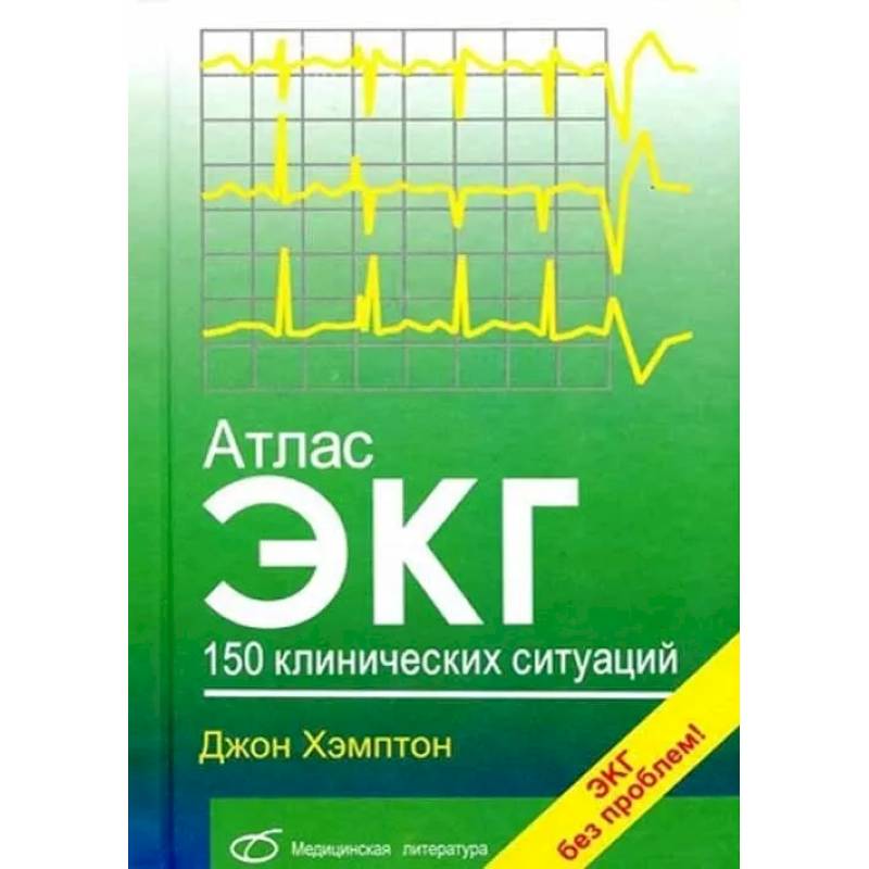 Атлас ЭКГ: 150 клинических ситуаций