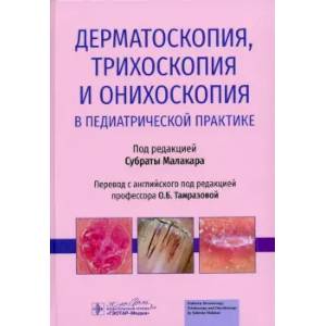 Дерматоскопия, трихоскопия и онихоскопия в педиатрической практике