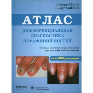 Дифференциальная диагностика поражений ногтей. Атлас