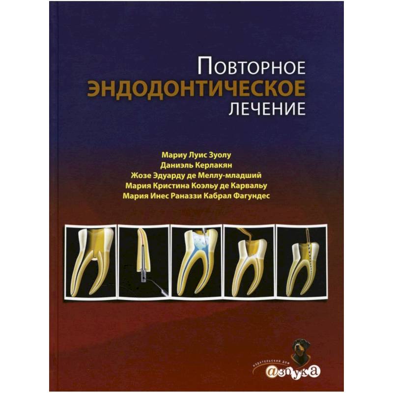 Повторное эндодонтическое лечение