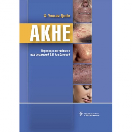 Диагностика и лечение, книга Акне купить по скидке