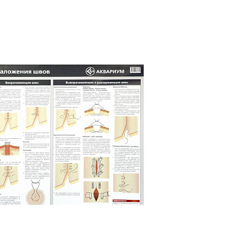 Плакат 'Техника наложения швов' 84х59 см. (в тубусе)