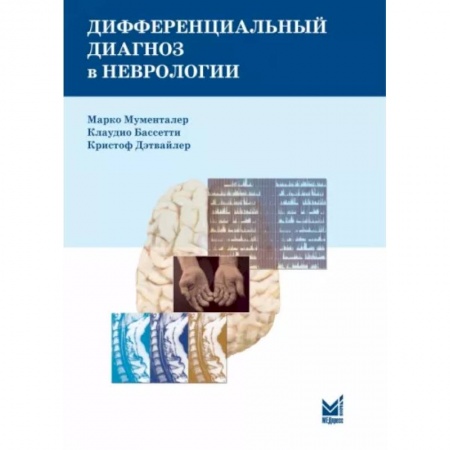Неврология, книга Дифференциальный диагноз в неврологии. Руководство по оценке, классификации и дифференциональной диагностике неврологических симптомов купить по скидке