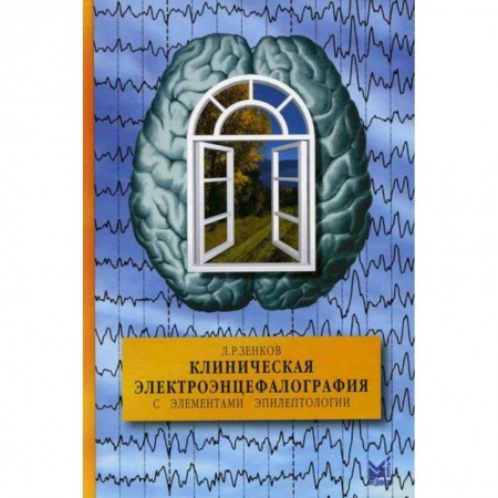 УЗИ. ЭКГ. Томография. Рентген, книга Клиническая электроэнцефалография (с элементами эпилептологии) купить по скидке