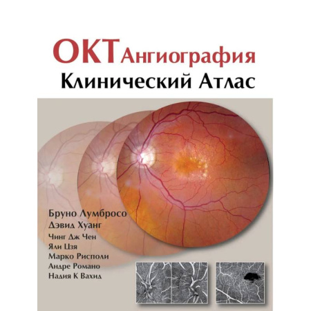 ЛОР. Оториноларингология, книга ОКТ-ангиография. Клинический атлас купить по скидке