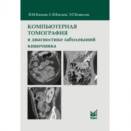 УЗИ. ЭКГ. Томография. Рентген, книга Компьютерная томография в диагностике заболеваний кишечника купить по скидке