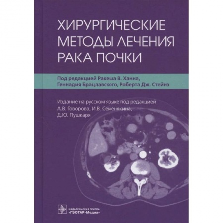 Урология, книга Хирургические методы лечения рака почки купить по скидке