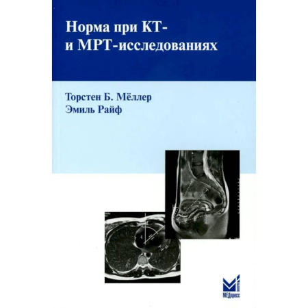 Другие виды специальной медицины, книга Норма при КТ- и МРТ-исследованиях купить по скидке
