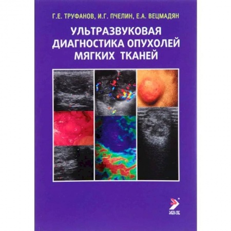 УЗИ. ЭКГ. Томография. Рентген, книга Ультразвуковая диагностика опухолей мягких тканей купить по скидке