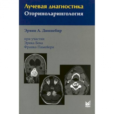 УЗИ. ЭКГ. Томография. Рентген, книга Лучевая диагностика. Оториноларингология купить по скидке