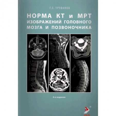Другие виды специальной медицины, книга Норма КТ-и МРТ-изображений головного мозга и позвоночника купить по скидке