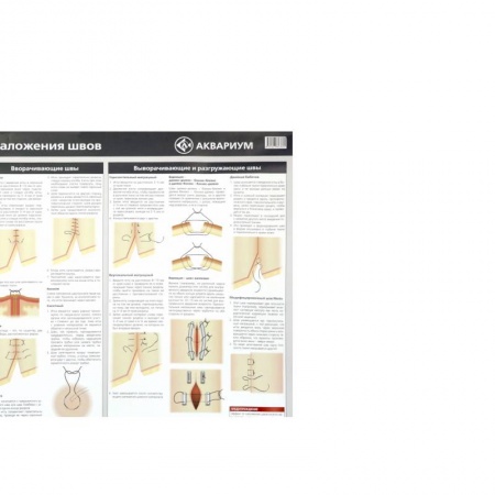 Демонстрационные материалы, книга Плакат 'Техника наложения швов' 84х59 см. (в тубусе) купить по скидке
