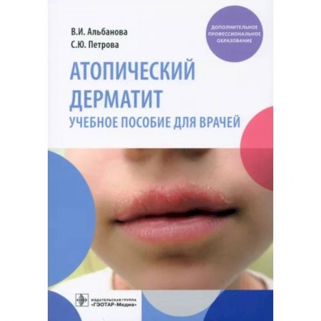 Кожные и венерические болезни, книга Атопический дерматит. Учебное пособие для врачей купить по скидке