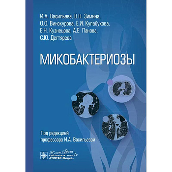 Микобактериозы