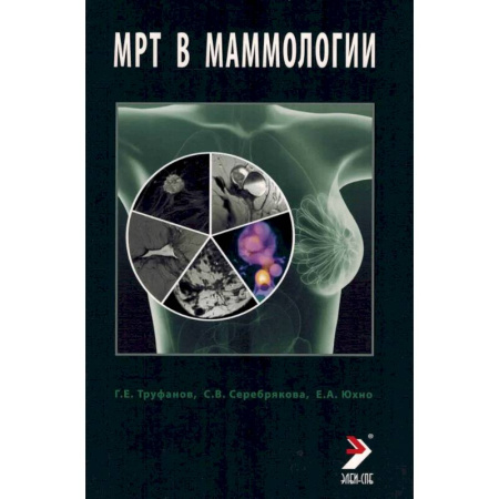 Медицинские энциклопедии и справочники, книга МРТ в маммологии: руководство для врачей купить по скидке